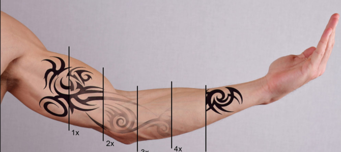 Gold Coast Tattoo Removal – Ideal Services To Get Rid Of Unwanted Tattoos Gold Coast Tattoo Removal – Ideal Services To Get Rid Of Unwanted Tattoos