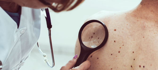 Things To Consider Prior Visiting Skin Cancer Prevention Brisbane Things To Consider Prior Visiting Skin Cancer Prevention Brisbane