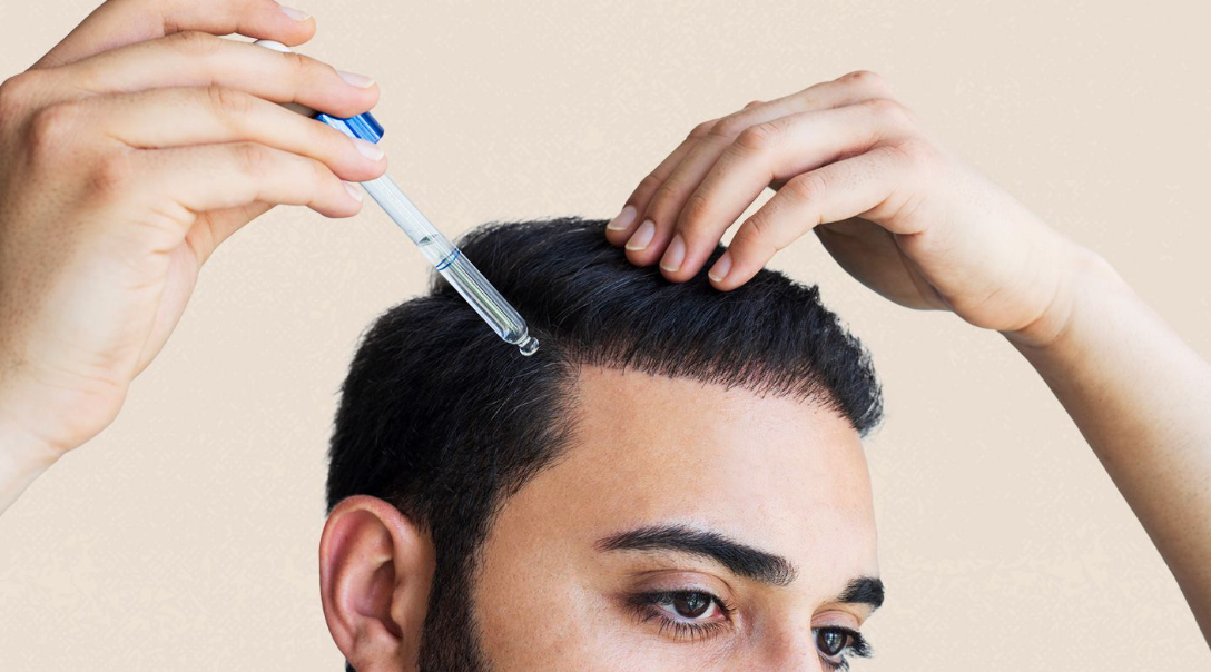 hair loss treatment in NZ