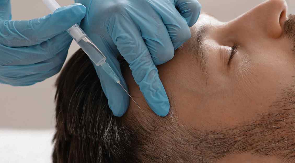What to Know Before Trying PRP for Hair Thinning What to Know Before Trying PRP for Hair Thinning